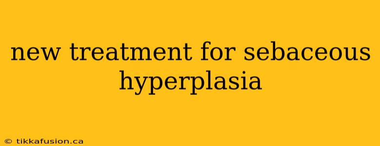 new treatment for sebaceous hyperplasia